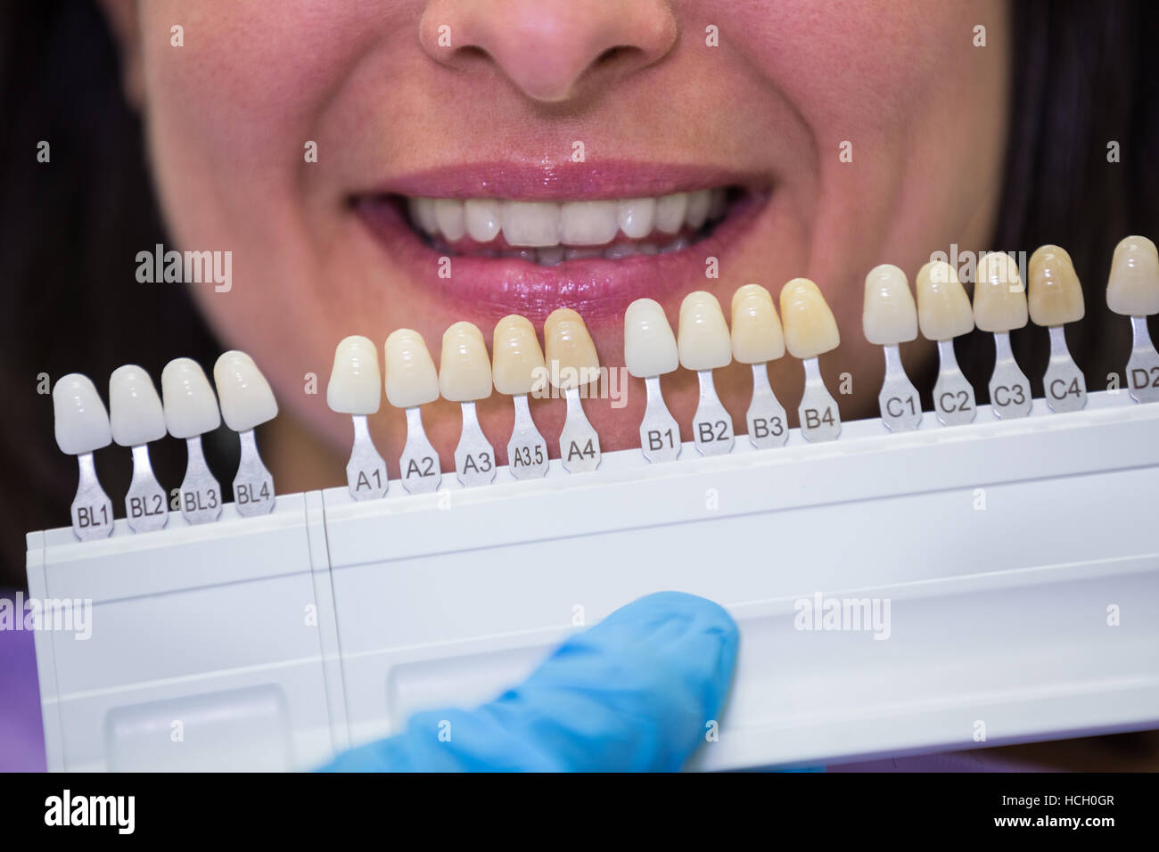 Dentista esame paziente femmina con sfumature dei denti Foto Stock
