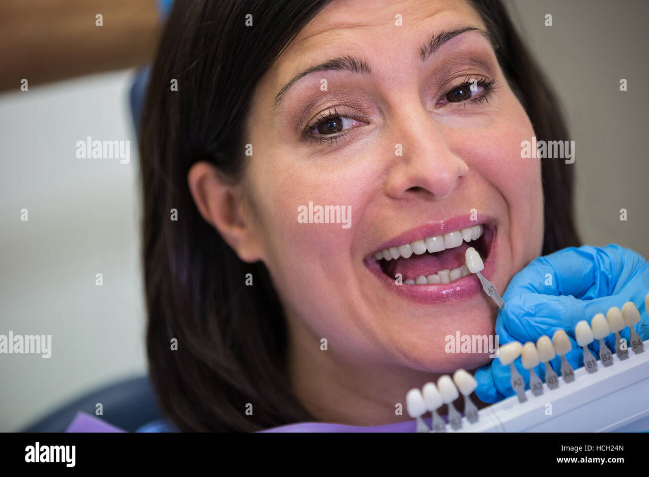 Dentista esame paziente femmina con sfumature dei denti Foto Stock