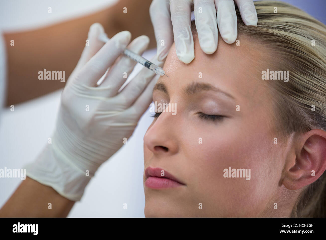 Paziente di sesso femminile riceve una iniezione di Botox sulla fronte Foto Stock