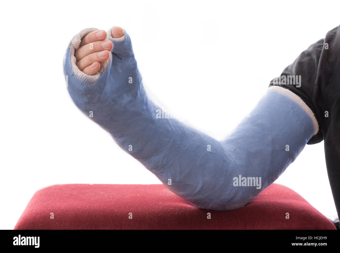 Un blu lungo braccio / gesso colato in fibra di vetro che coprono il polso, il braccio e il gomito in appoggio su un ottomano, isolato su bianco Foto Stock