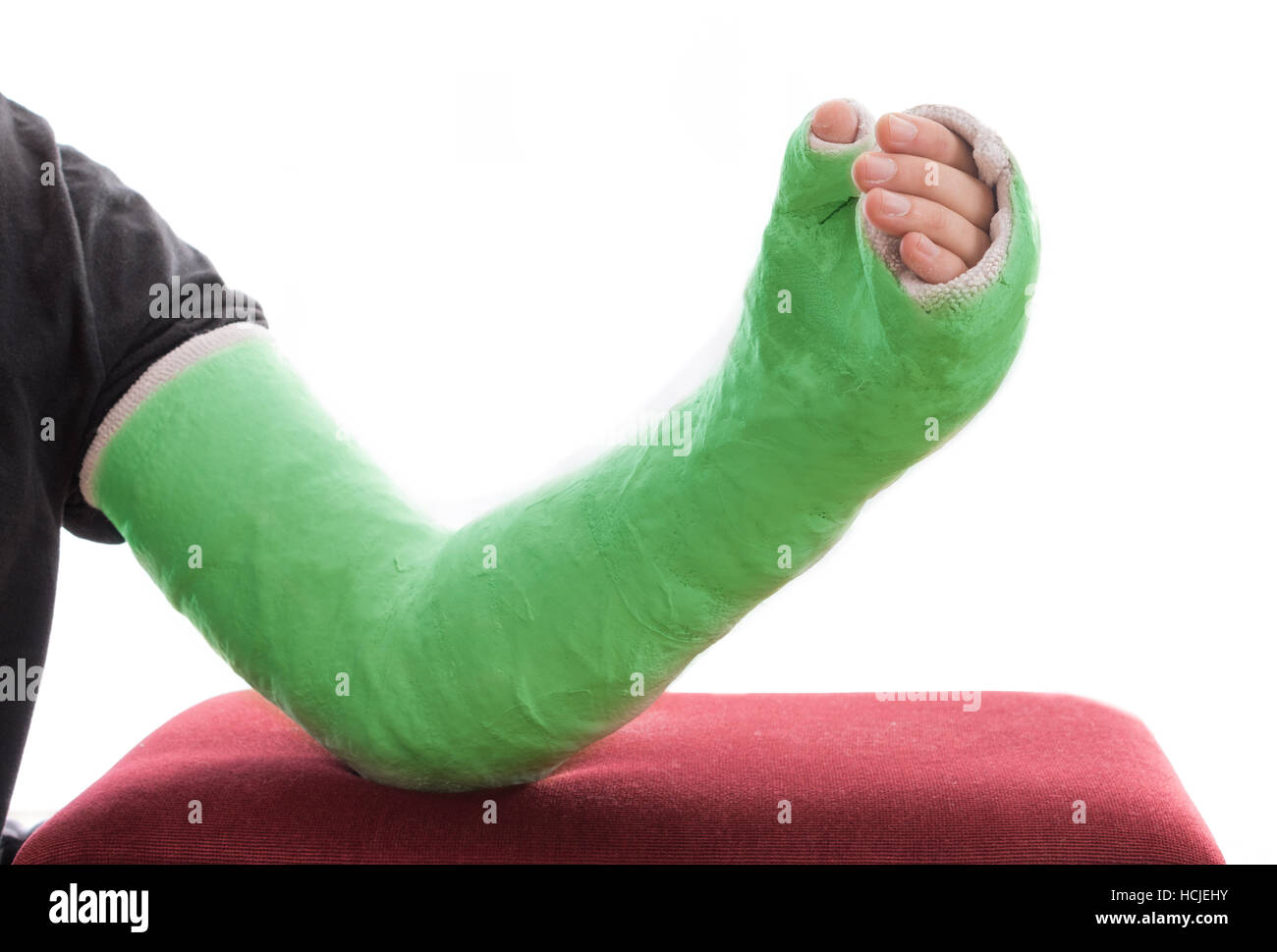 Un verde lungo braccio / gesso colato in fibra di vetro che coprono il polso, il braccio e il gomito in appoggio su un ottomano, isolato su bianco Foto Stock