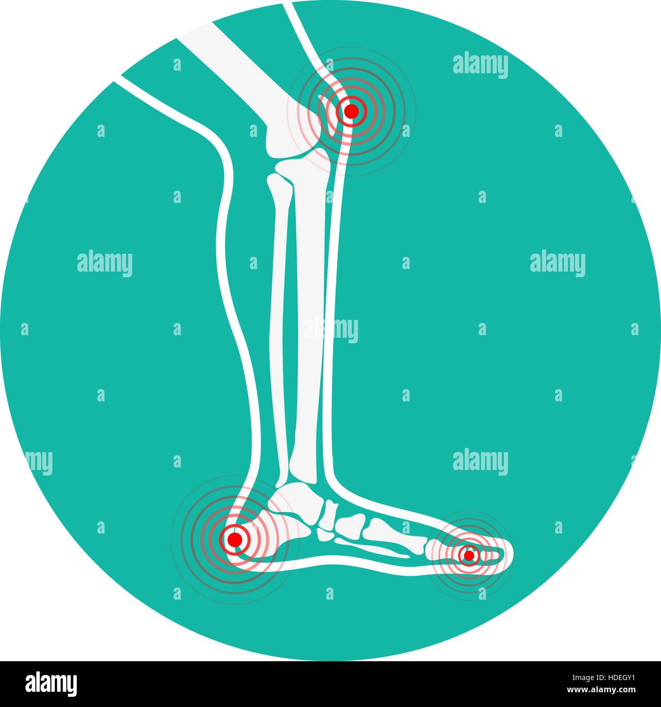 Gamba umana zone di dolore. Gli elementi di design per una infografica. Illustrazione Vettoriale. Illustrazione Vettoriale