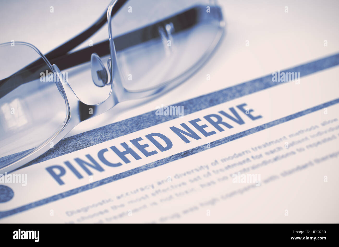 Nervo schiacciato - Diagnosi stampato su sfondo blu e bicchieri giacente su di esso. Il concetto di medicina. Immagine sfocata. Il rendering 3D. Foto Stock