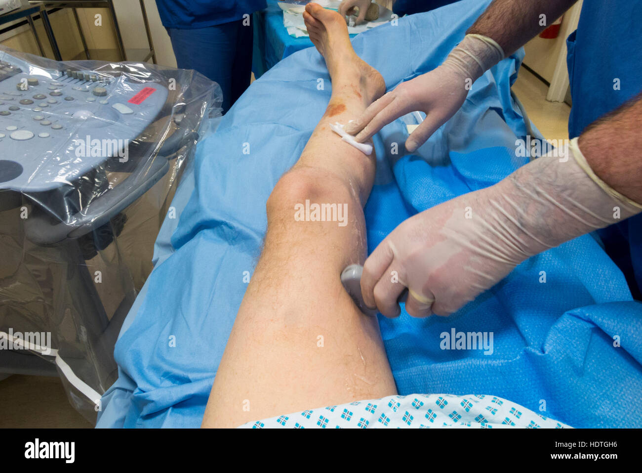 Ultrasuoni / ultra suono eseguite scansioni su paziente 's gamba / gambe: chirurgia  vascolare / procedura chirurgica / vena varicosa vene REGNO UNITO Foto  stock - Alamy