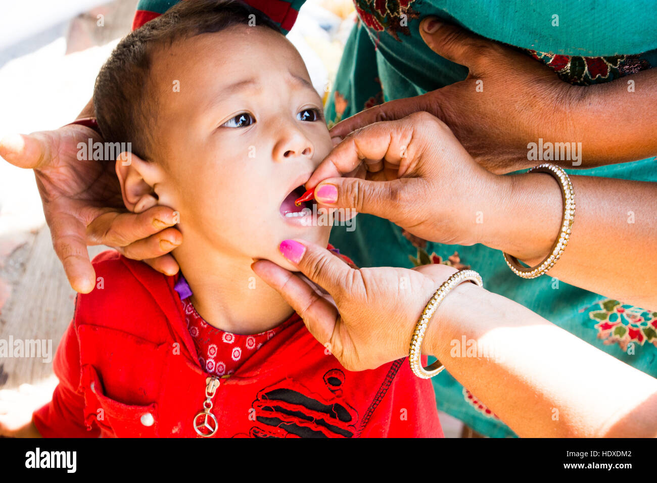 Ragazzo giovane getting ONG distribuiti vitamina a gocce in Kathmandu, Nepal Foto Stock