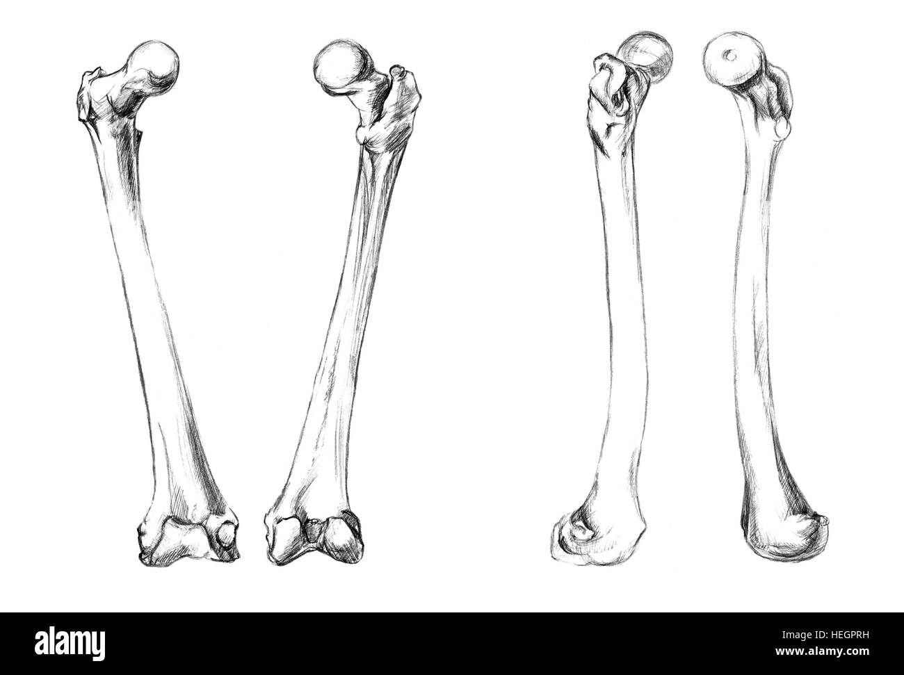 Le ossa della coscia (femore), disegnato a mano Illustrazione medica disegno con imitazione litografia Foto Stock