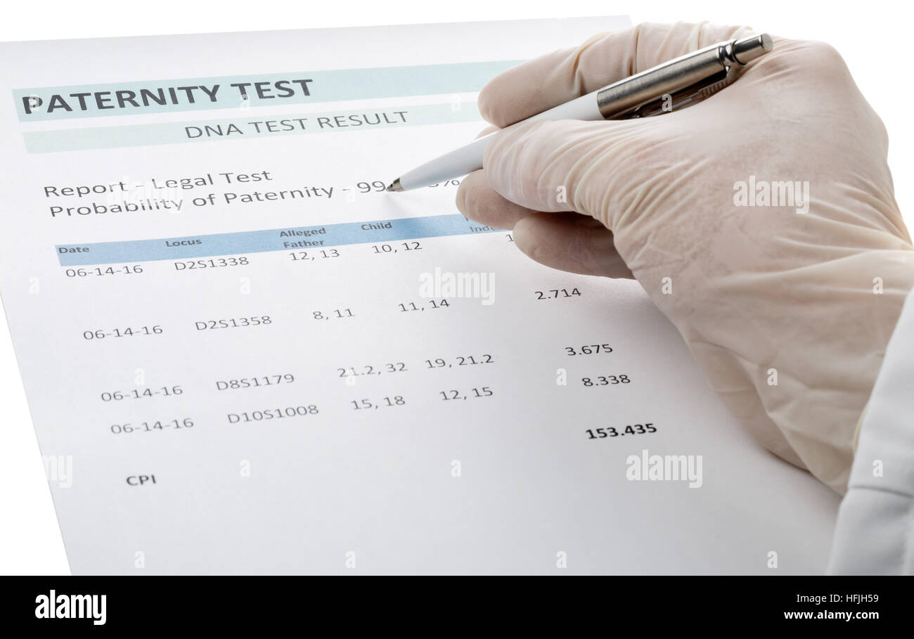 Il congedo di paternità DNA Risultato test chart form - medico puntando al valore di risultato Foto Stock