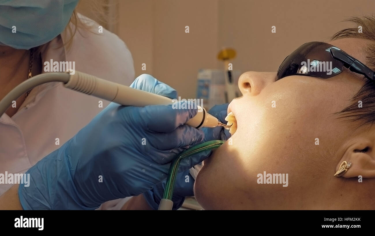 Donna dente ad ultrasuoni odontolith placca rimozione Foto Stock