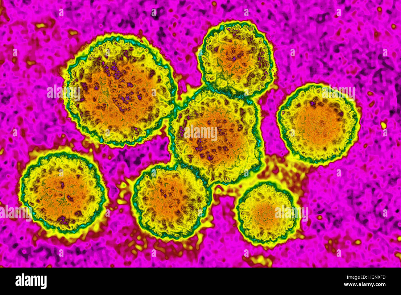 VIRUS DELLA ROSOLIA Foto Stock