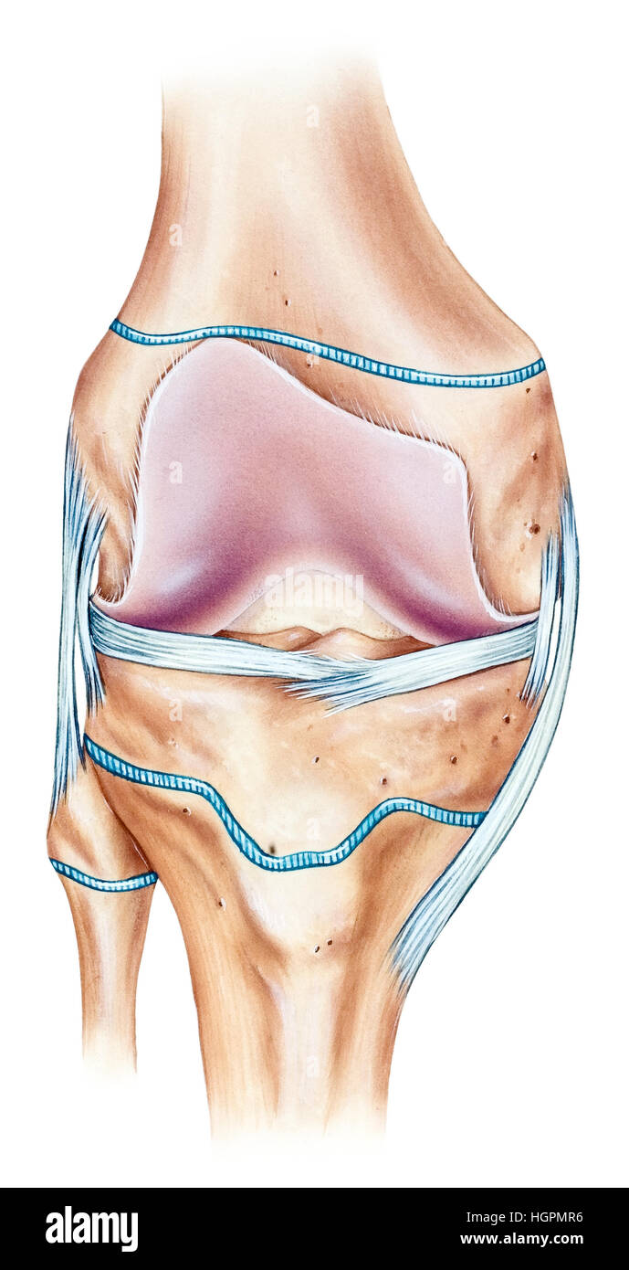 Problemi al ginocchio di un giovane atleta. In una persona giovane del ginocchio, vi sono metabolicamente attivo del femore distale e della tibia prossimale physeal piastre tra t Foto Stock