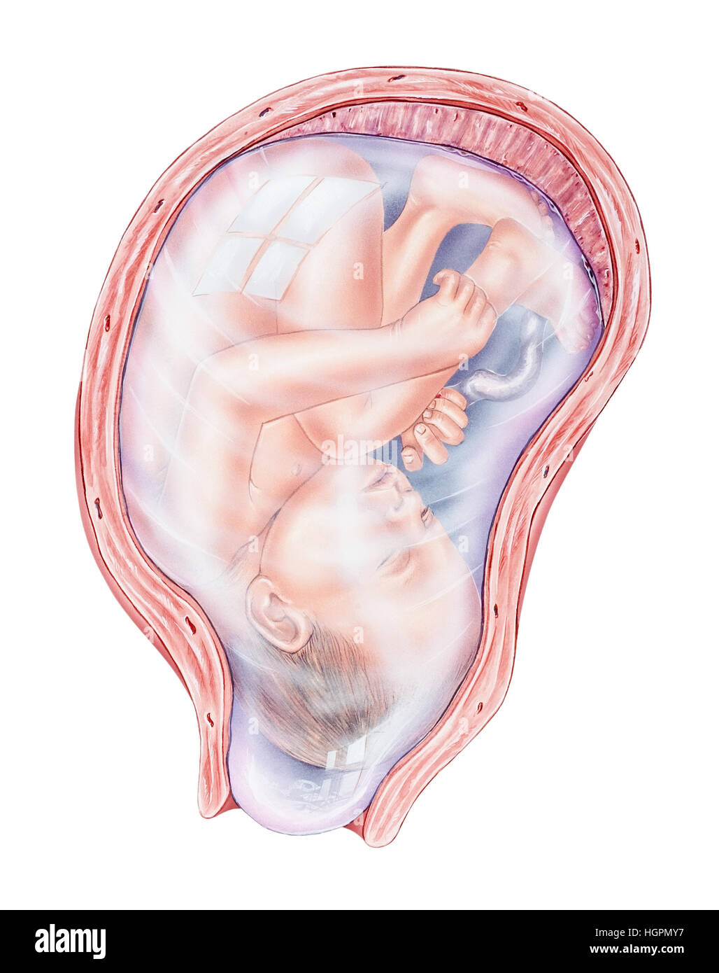 Mostrate sono il feto e la placenta (nella parte superiore dell'utero), cordone ombelicale, utero, il rigonfiamento del sacco amniotico e la dilatazione della cervice. Il grado Foto Stock