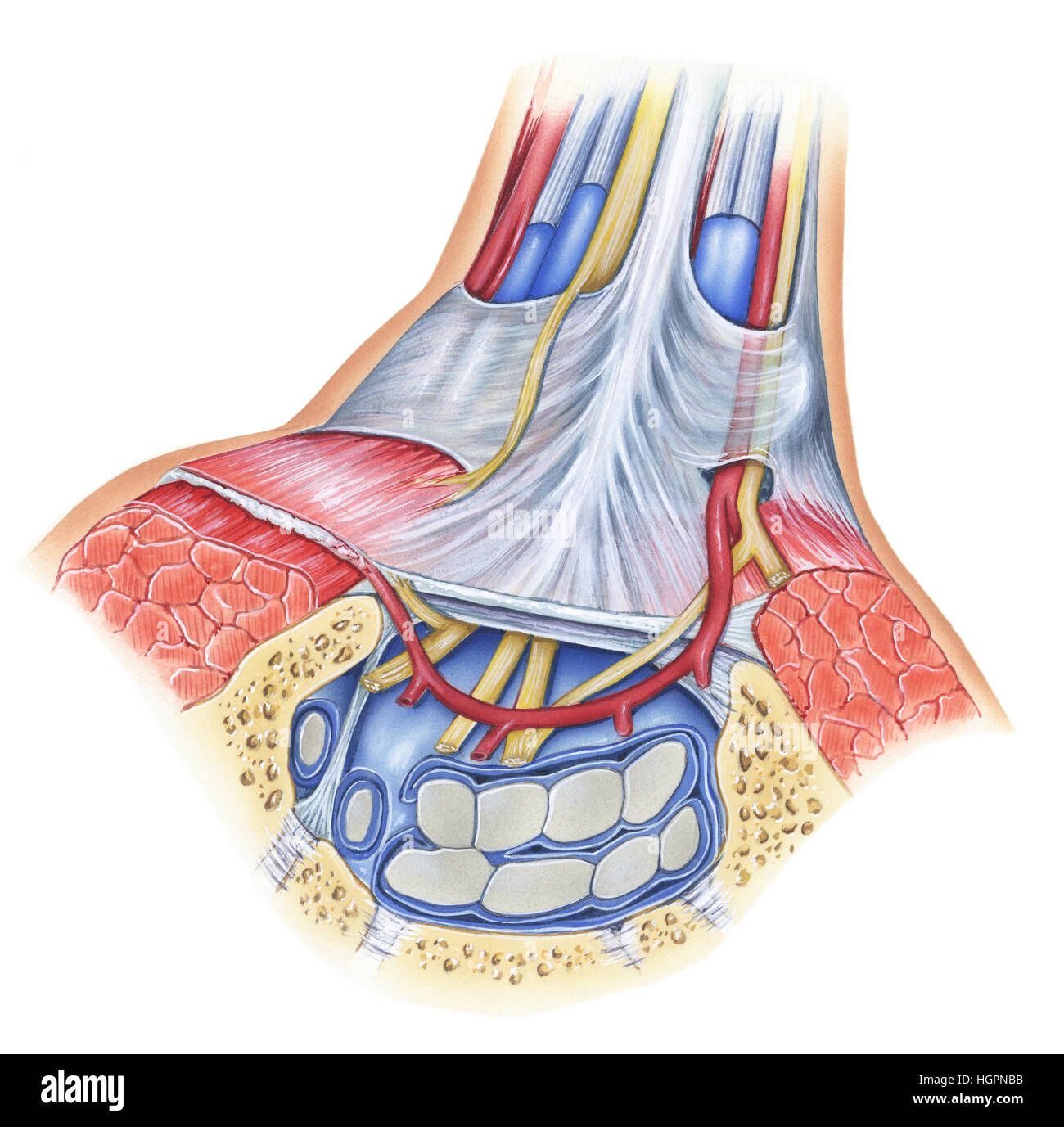 La sindrome del tunnel carpale è mediale di compressione del nervo in corrispondenza del polso e dispone di una vasta gamma di cause come stress ripetitivo, risultante in un uso eccessivo micratraum Foto Stock