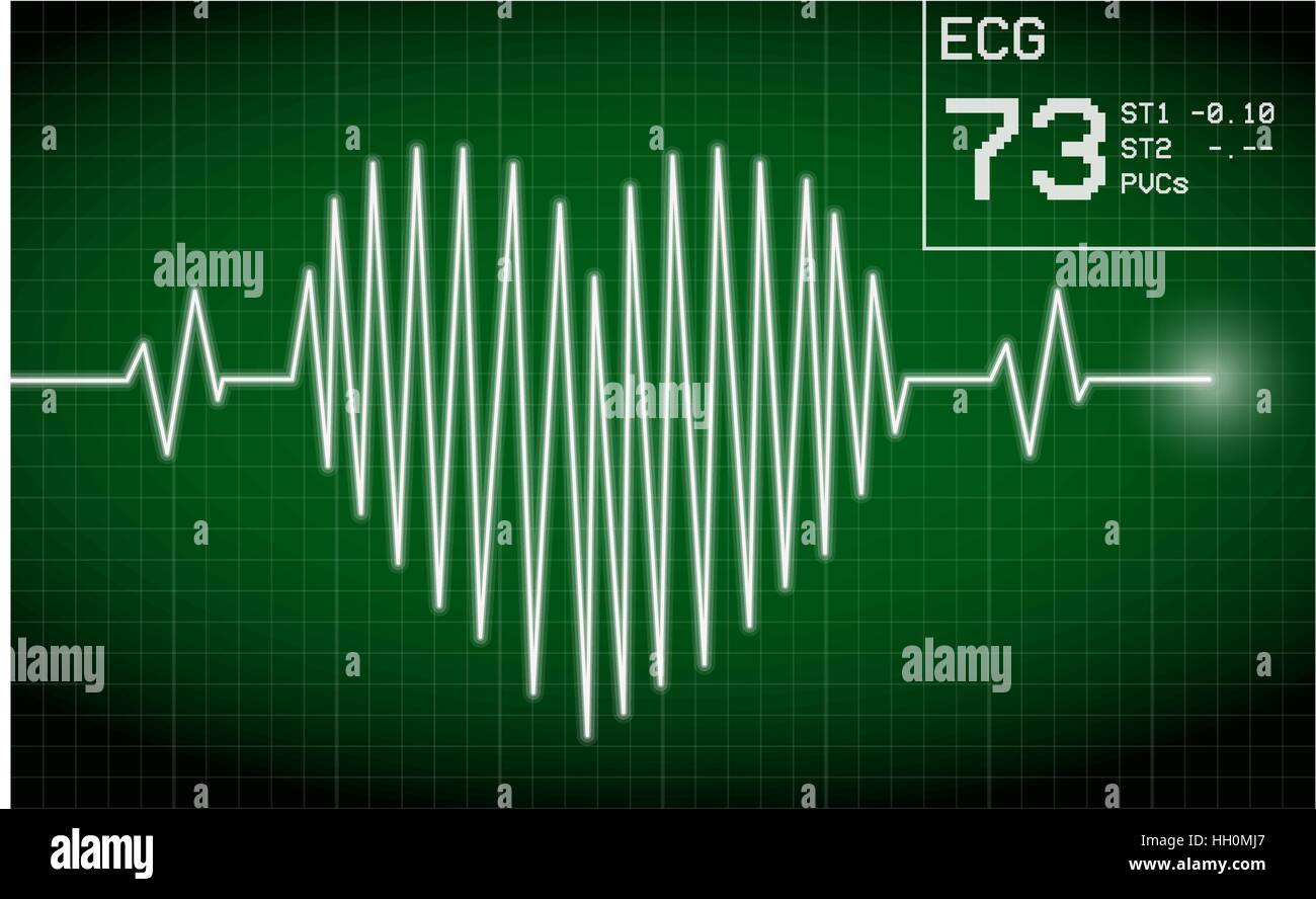 Heartbeat sul display Illustrazione Vettoriale