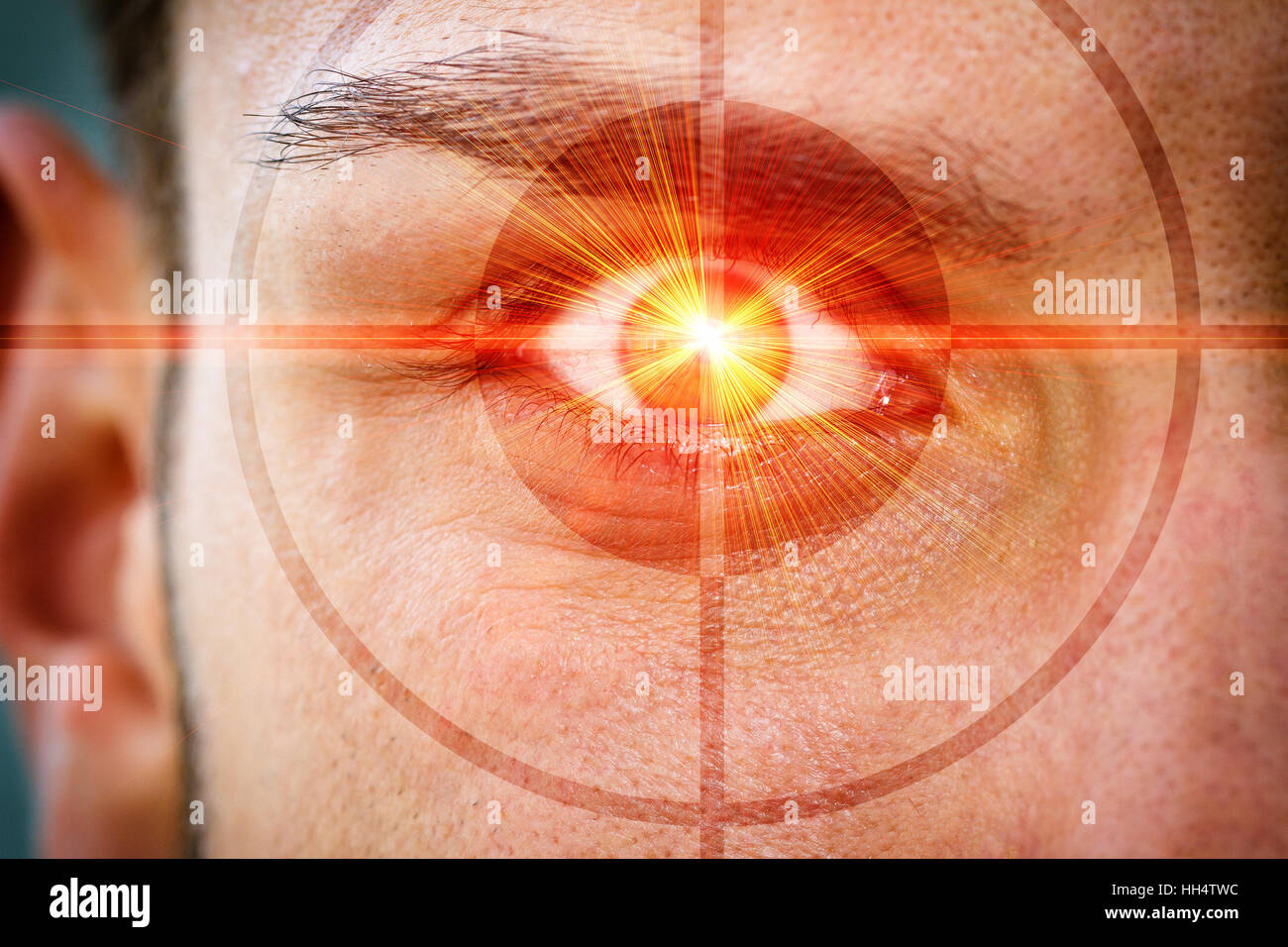 Laser rosso e reticolo su di un occhio Foto Stock