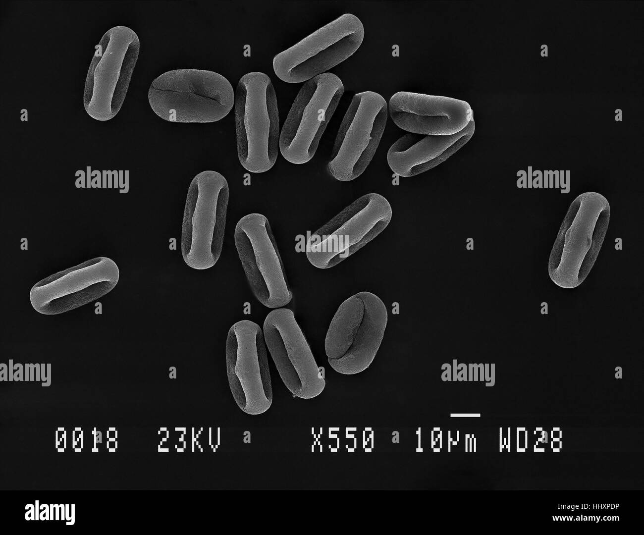 Molti mucca prezzemolo (Anthriscus sylvestris) dei grani di polline ingrandito sotto un microscopio elettronico a scansione (SEM), dimostrando la forma a diversi angoli. Foto Stock Molti mucca prezzemolo (Anthriscus sylvestris) dei grani di polline ingrandito sotto un microscopio elettronico a scansione (SEM), dimostrando la forma a diversi angoli. Foto Stock