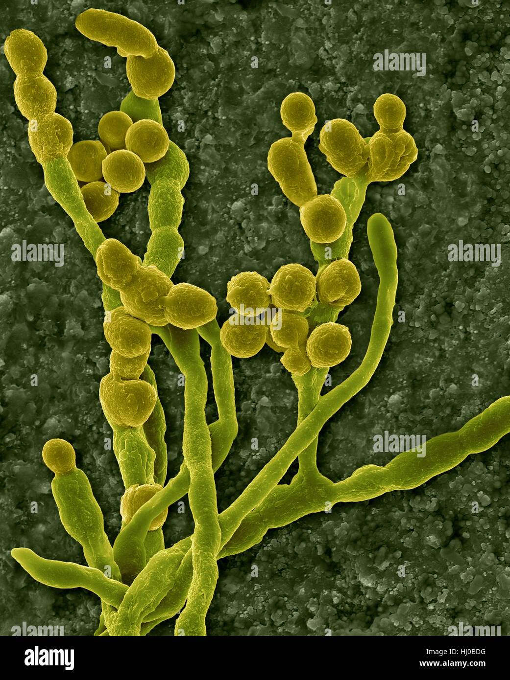 Color scanning electron microfotografia (SEM) di comuni allergeni ambientali stampo (Cladosporium sp.); fungal hyphae producono spore.noto anche come Hormodendrum sp.Questo esemplare è stato trovato sulla superficie interna della costruzione dell'aria del condotto di alimentazione.questo genere è più comune outdoor airborne stampo ma può verificarsi Foto Stock