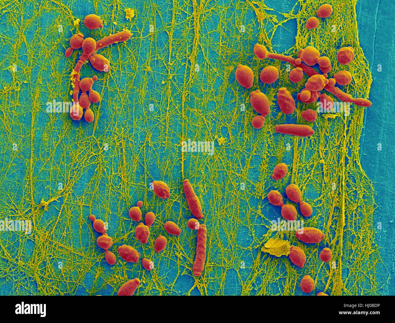 Color scanning electron microfotografia (SEM) di Candida albicans infetto catetere medicale.Un lievito comune,C.albicans possono colonizzare i cateteri con conseguenti gravi infezioni del tessuto.qui illustrata è la superficie interna del catetere infetti (rimosso dal paziente) rivelando di lievito (biofilm Candida Foto Stock Color scanning electron microfotografia (SEM) di Candida albicans infetto catetere medicale.Un lievito comune,C.albicans possono colonizzare i cateteri con conseguenti gravi infezioni del tessuto.qui illustrata è la superficie interna del catetere infetti (rimosso dal paziente) rivelando di lievito (biofilm Candida Foto Stock