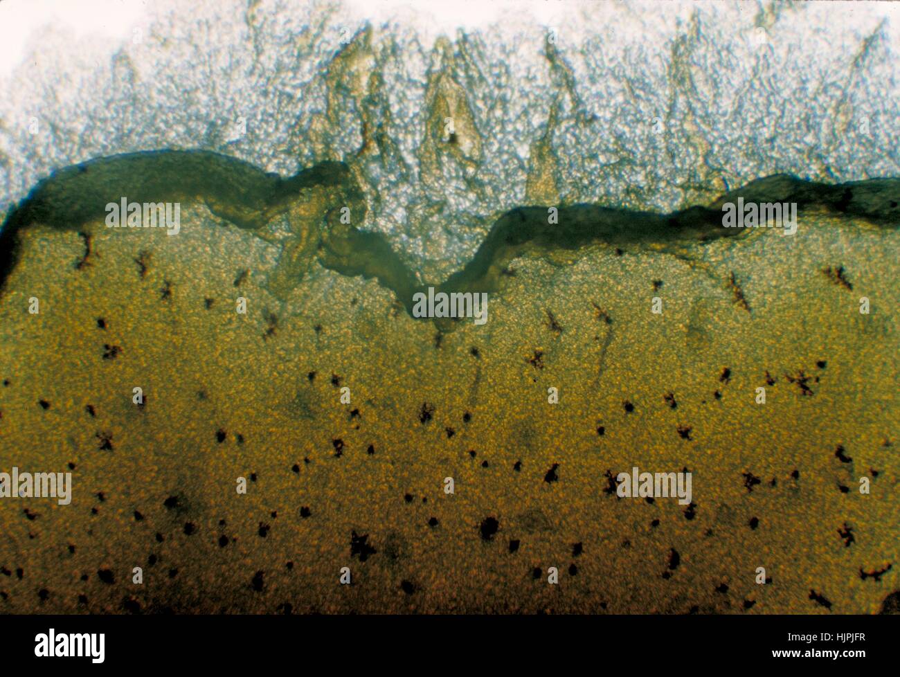 Questa estrema close-up di una piastra di coltura Mycobacterium balnei rivela un buon margine di colonia con luce trasmessa, 1965. La crescita della coltura avviene in 7-14 giorni, ed è ottimale a 32°C. M. balnei, noto anche come Mycobacterium marinum, è un animale-patogeno associato, e infezione può verificarsi a seguito di un trauma della pelle in fresche o acqua salata. Immagine cortesia CDC/Dott. Charles C. Shepard. Foto Stock