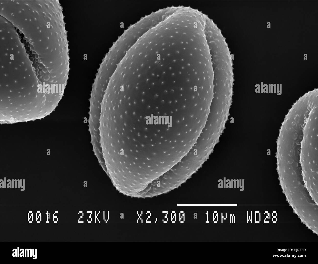 Micrografia elettronica a scansione di una particella di polline da lesser celandine fiore. Nottingham, UK. aprile. Foto Stock