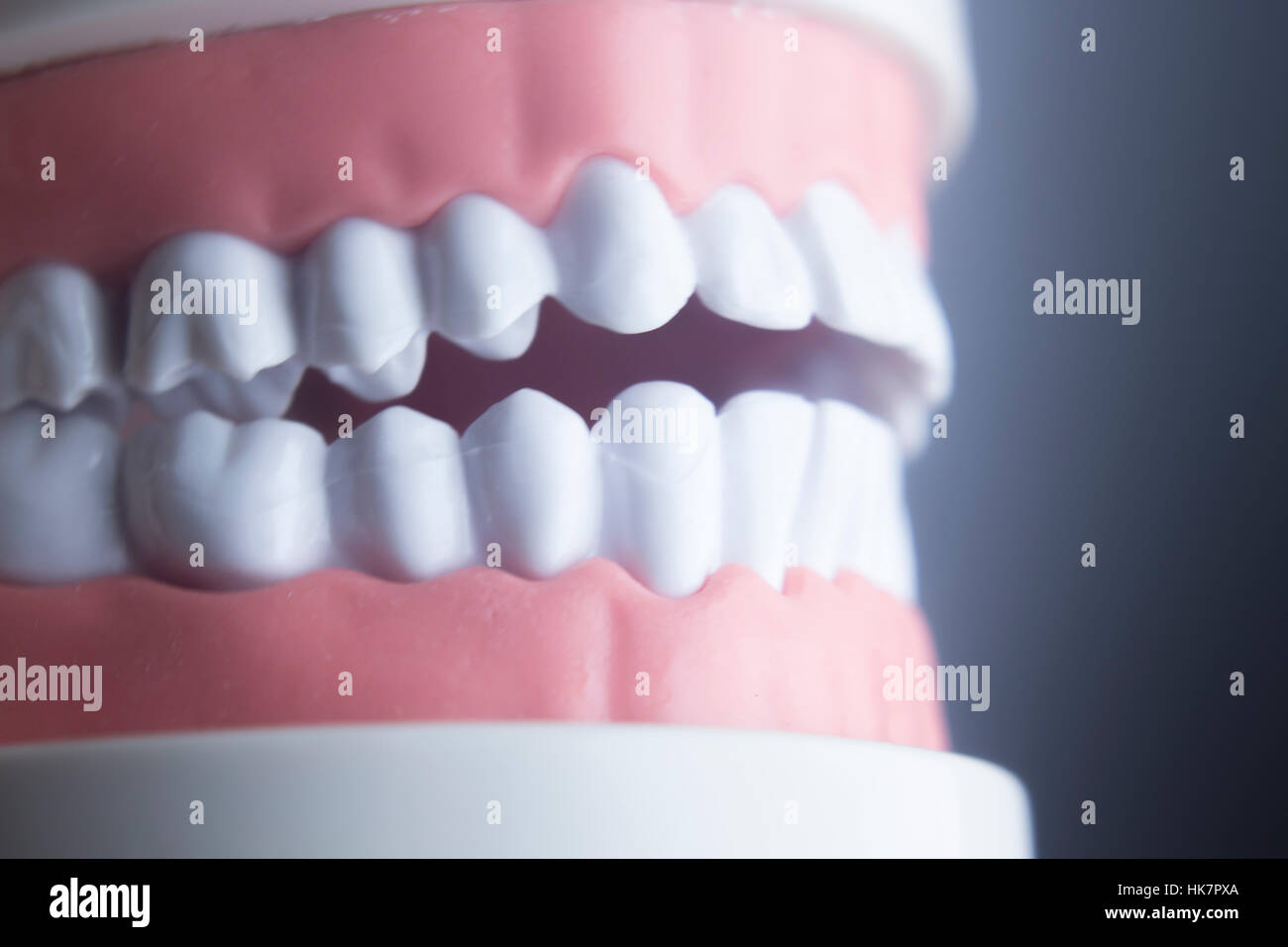 Dente Dentale Odontoiatria Apprendimento Dello Studente Modello Didattico Che Mostra Denti Radici Gomme Malattie Gengivali Carie E Placca 132377007