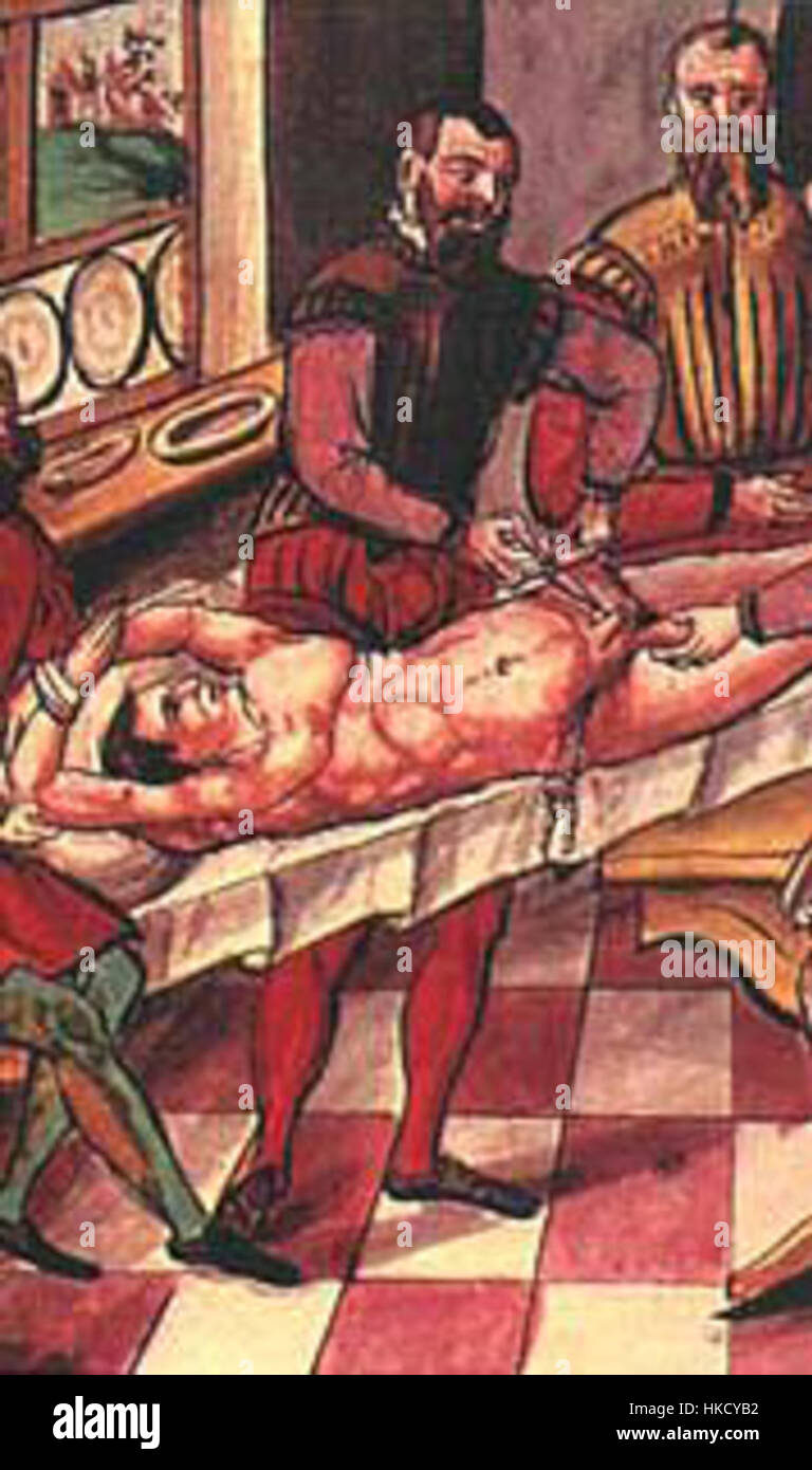 Il dipinto "castrazione" affronta il tema intenso e drammatico, raffigurando il processo doloroso e spesso controverso in contesti storici e medici. L'artista cattura l'emozione grezza e la gravità della scena, concentrandosi sull'esperienza umana e sulla natura complessa della sofferenza corporea. Foto Stock