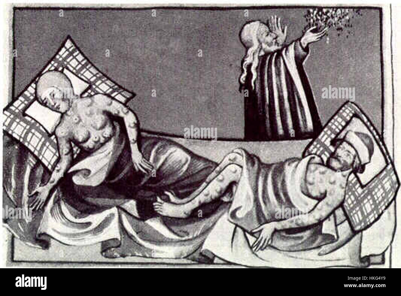 L'illustrazione della Bibbia di Toggenburg che raffigura il vaiolo evidenzia la presenza storica e l'impatto delle malattie nel periodo medievale. Questa opera d'arte riflette il contesto sociale e medico del suo tempo. Foto Stock