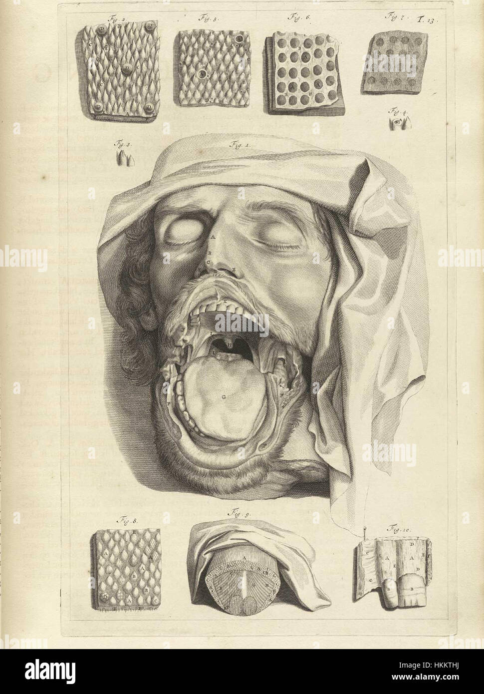 L'illustrazione anatomica "Ontleding" di Bidloo del 1690 è un disegno medico dettagliato che mostra la dissezione del corpo umano, contribuendo ai progressi del XVII secolo negli studi anatomici e nell'arte medica. Foto Stock