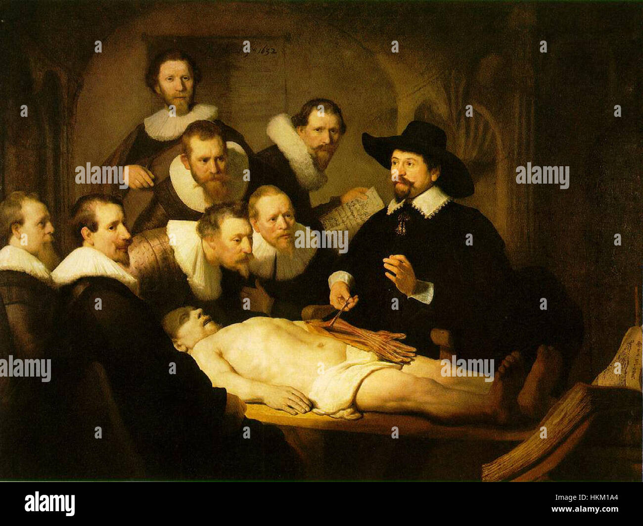"Anatomie" di Nicolaes Tulp è un rinomato dipinto del XVII secolo che raffigura una dissezione pubblica ad Amsterdam. Il lavoro riflette i progressi scientifici e medici del periodo, con Tulp che dimostra l'anatomia umana. Foto Stock