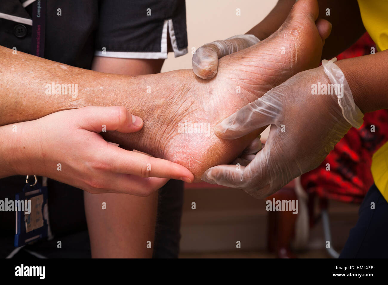 Il piede di una donna anziana in fase di ispezione / valutazione dei piedi su un anziano / oap / anziano donna / salute della persona, ma personale medico in un ambiente di cura. REGNO UNITO. (85) Foto Stock