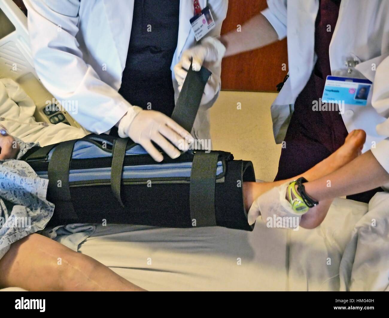 Una terapia di compressione gamba tutore è dotato di un piccolo paziente ricoverato in ospedale dopo intervento chirurgico al ginocchio. È utilizzata negli ospedali per la prevenzione di trombosi venosa profonda o profonde Foto Stock