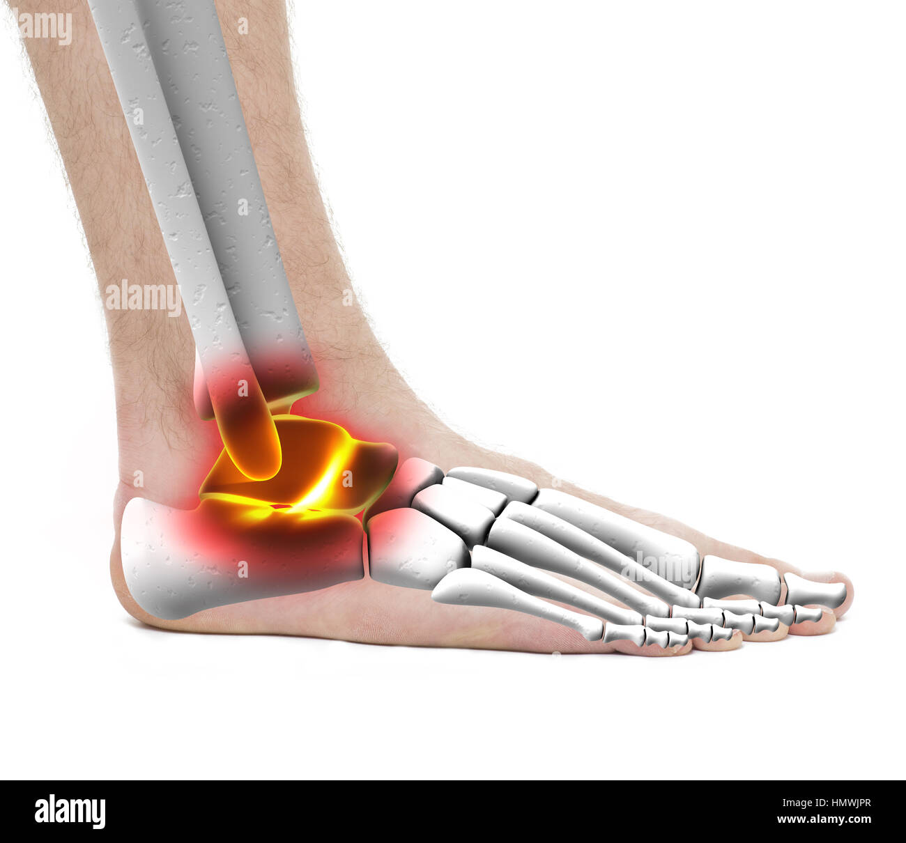 Il dolore della caviglia pregiudizio - Anatomia maschio - Studio foto isolato su bianco Foto Stock