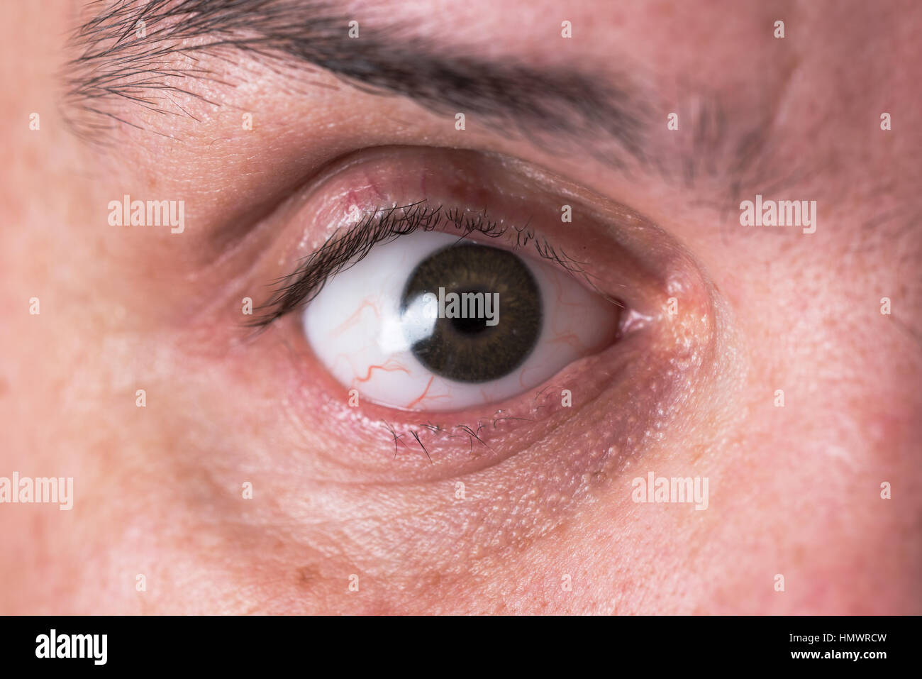 Occhio di vetro Protesi Protesi Oculari Foto Stock