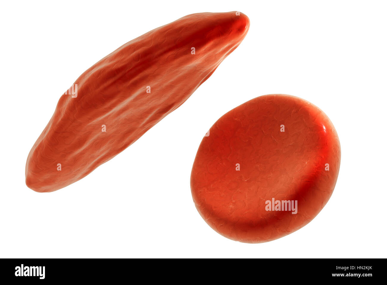 Computer illustrazione delle normali cellule rosse del sangue e a forma di mezzaluna le cellule rosse del sangue come riscontrato in anemia falciforme. Foto Stock
