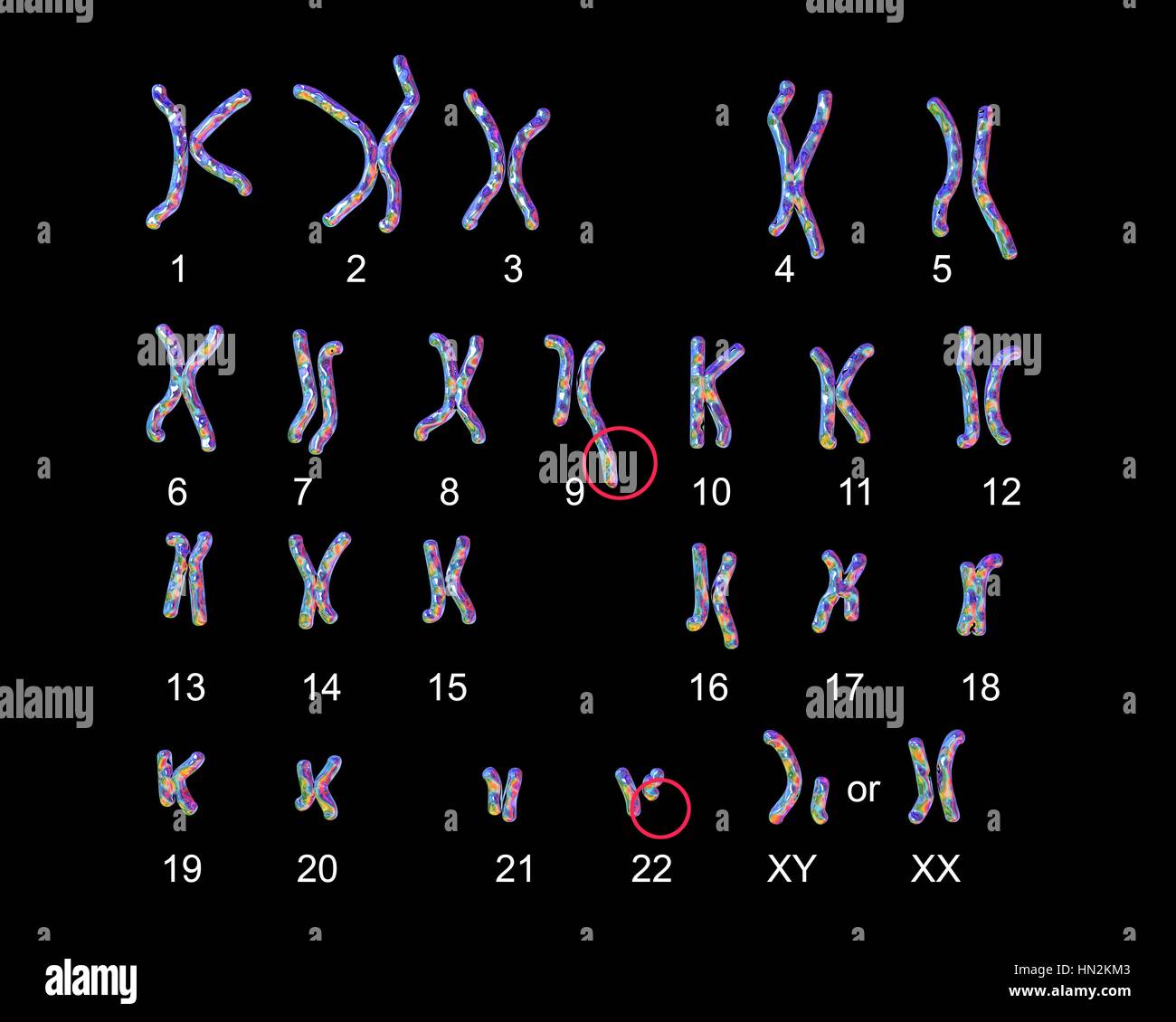 Philadelphia chromosome.Computer illustrazione del maschio o femmina del cariotipo cromosoma (set) un cromosoma difettoso ciascuno da coppie 9 22.I DIFETTI,sul lato destro i cromosomi di due coppie,causare leucemia mieloide cronica (CML).Il 46 cromosomi del cariotipo umano sono qui disposti in coppie 23 Foto Stock