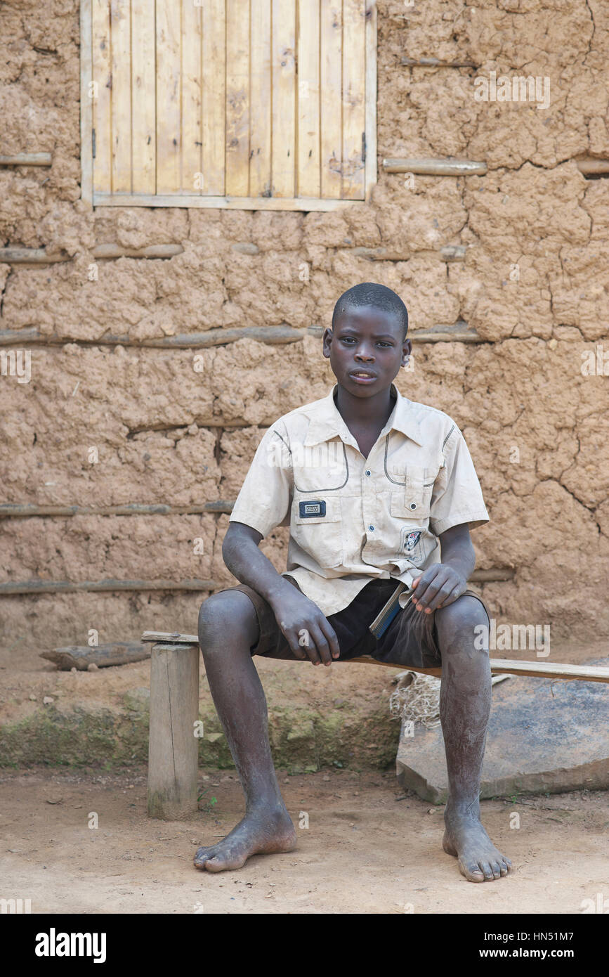 Ritratto di giovane orfano ragazzo ugandese fissando la telecamera senza scarpe Foto Stock