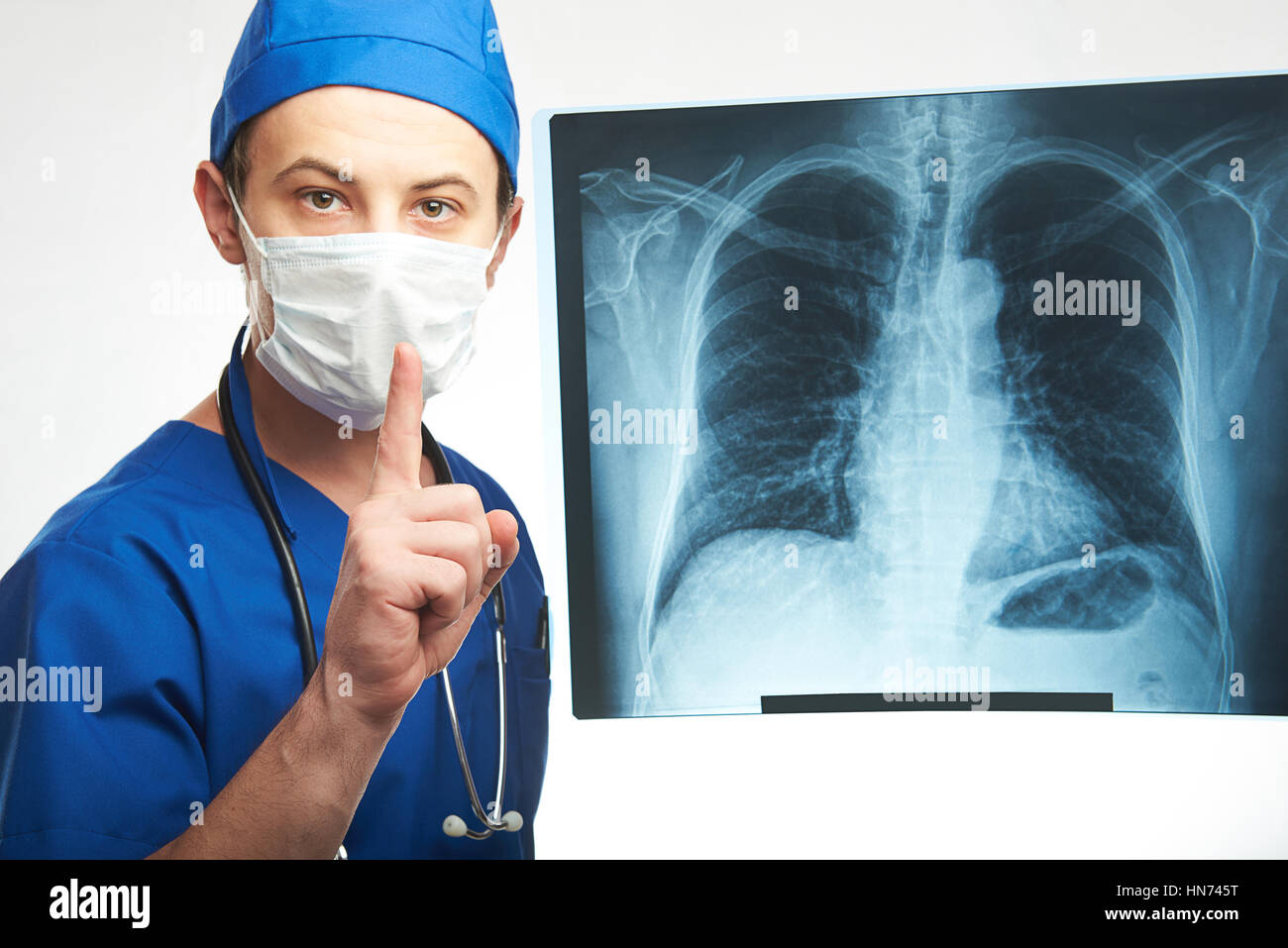 Medico con il dito fino alla successiva immagine a raggi x dei polmoni Foto Stock