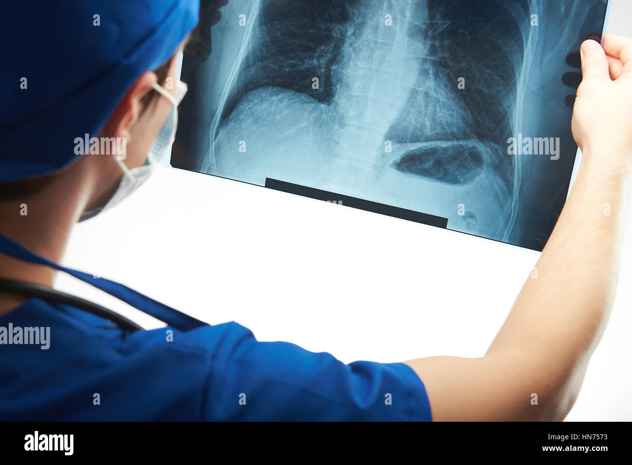 Medico guardare immagine a raggi x del torace dell'uomo isolato su bianco Foto Stock