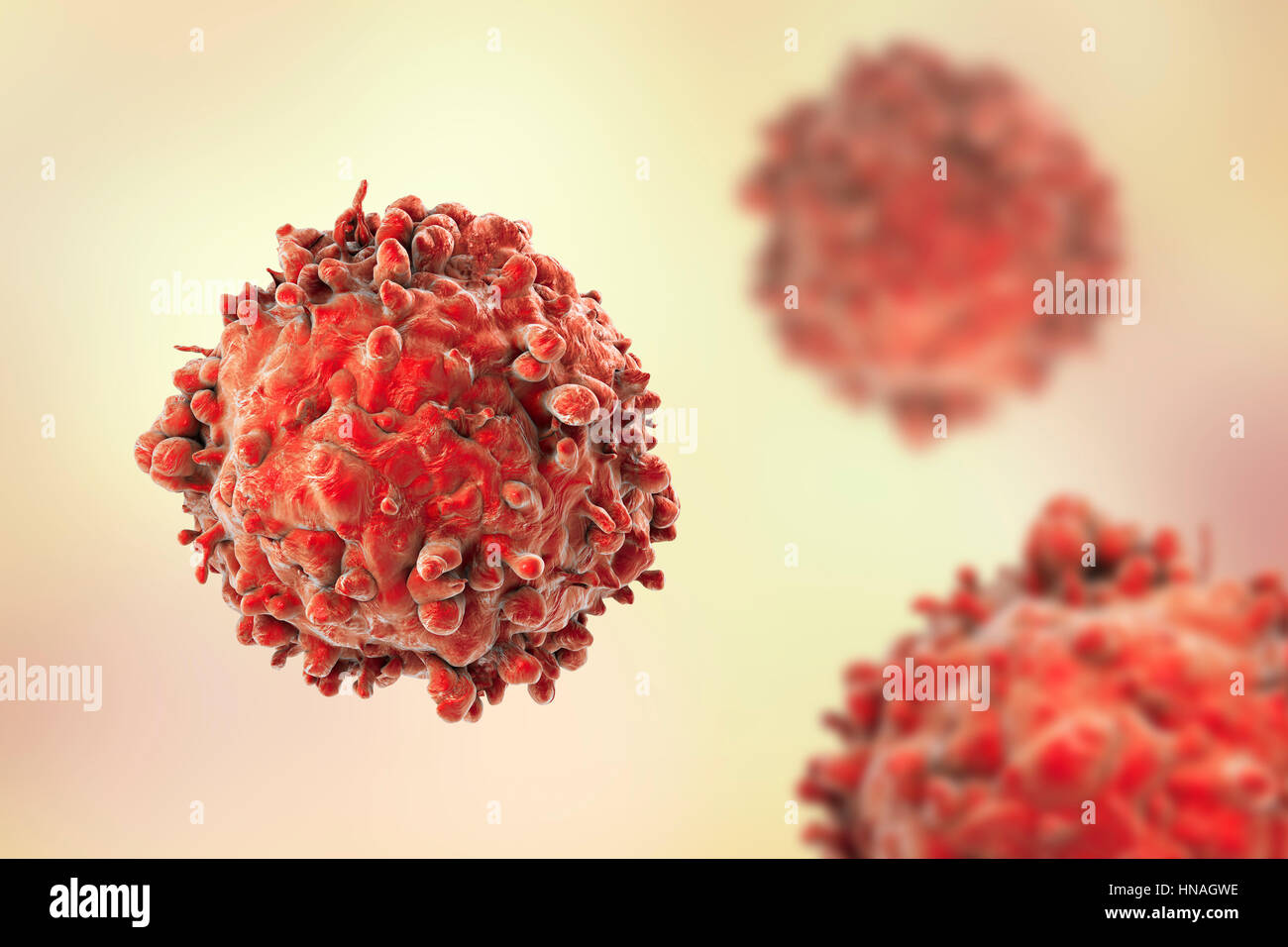 Computer illustrazione di un cancro delle cellule bianche del sangue nella leucemia. Foto Stock
