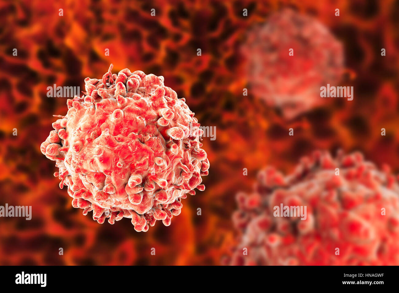 Computer illustrazione di un cancro delle cellule bianche del sangue nella leucemia. Foto Stock