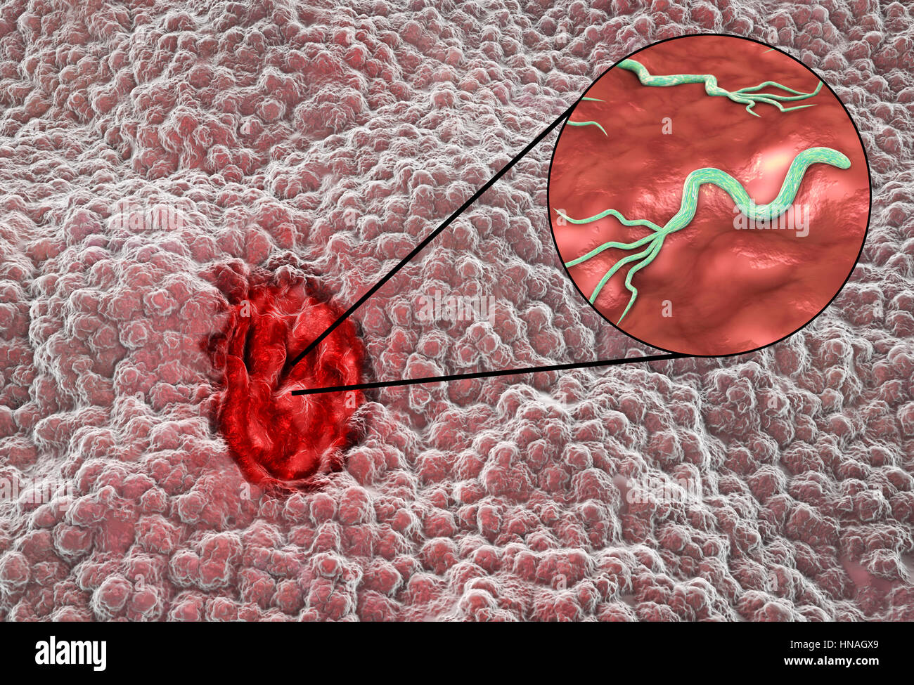Helicobacter pylori bacteria immagini e fotografie stock ad alta  risoluzione - Alamy