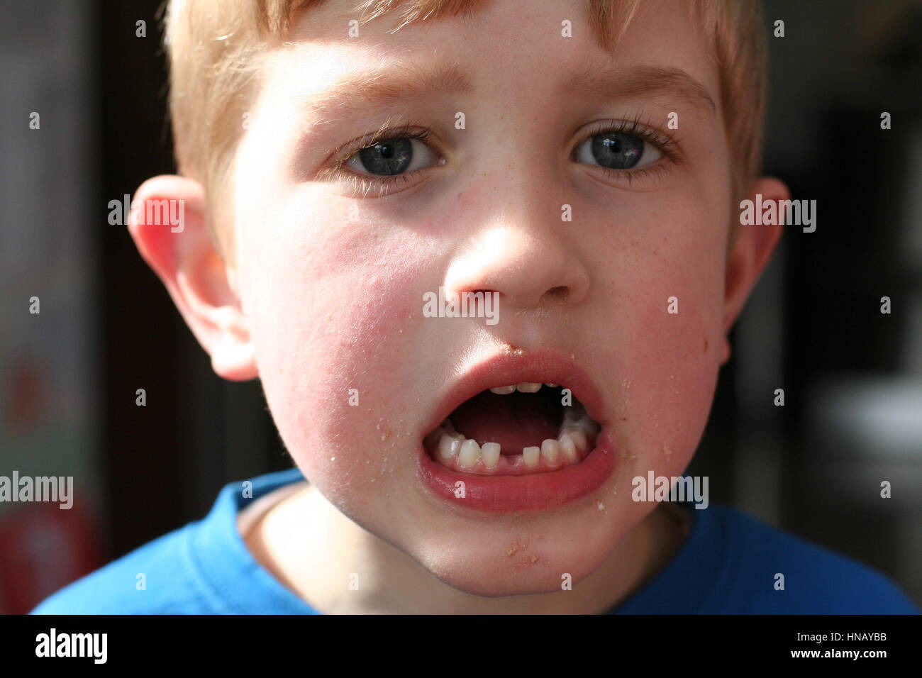 Piccolo ragazzo biondo bambino kid cercando certi, ansioso avendo perso il suo primo dente, dente fata, dente inferiore Foto Stock