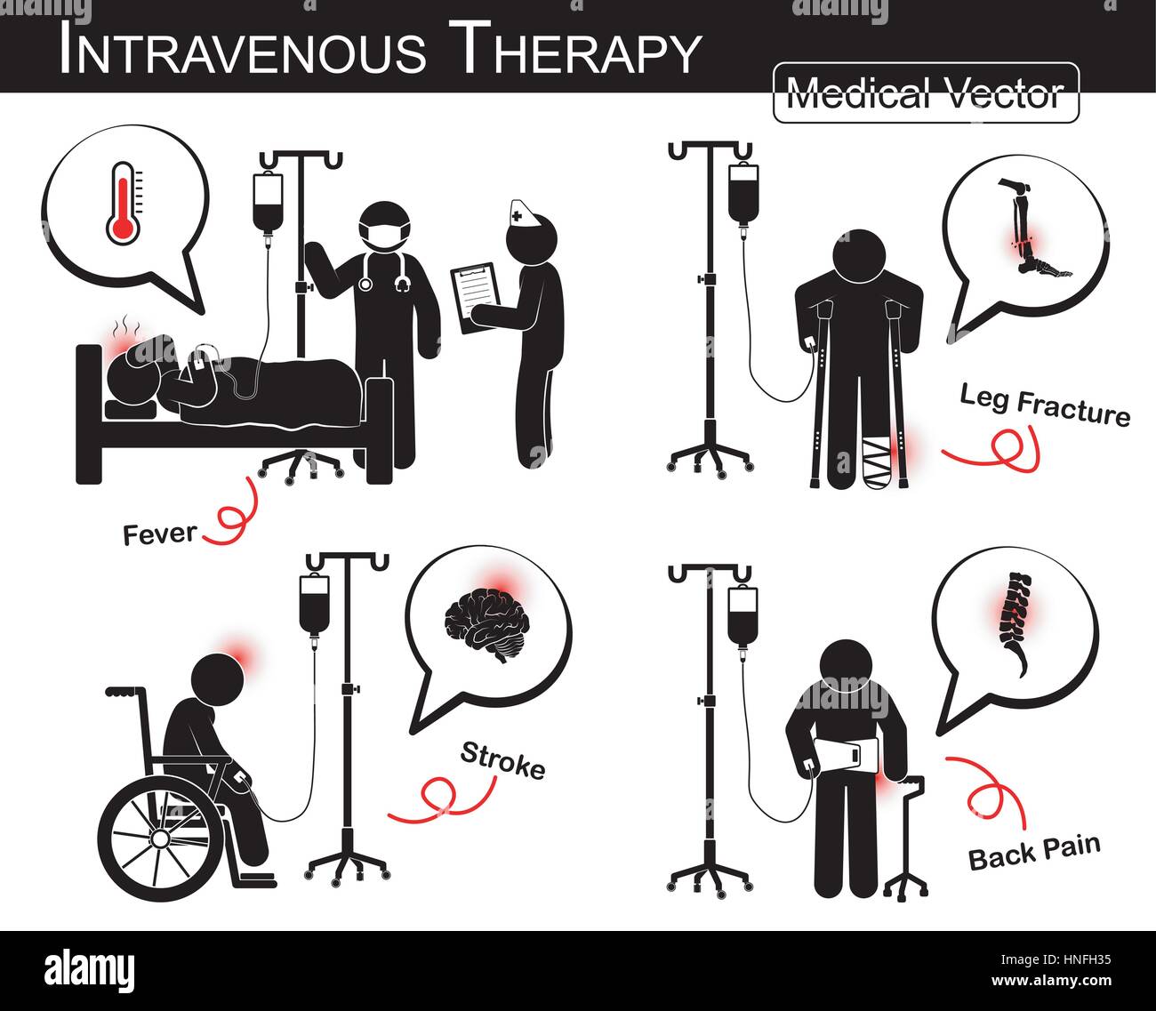 Set di vettore stick man : paziente con malattia multipli con fluido intravenoso ( design piatto , bianco nero stile )( Medical e il concetto di scienza )( Fev Illustrazione Vettoriale