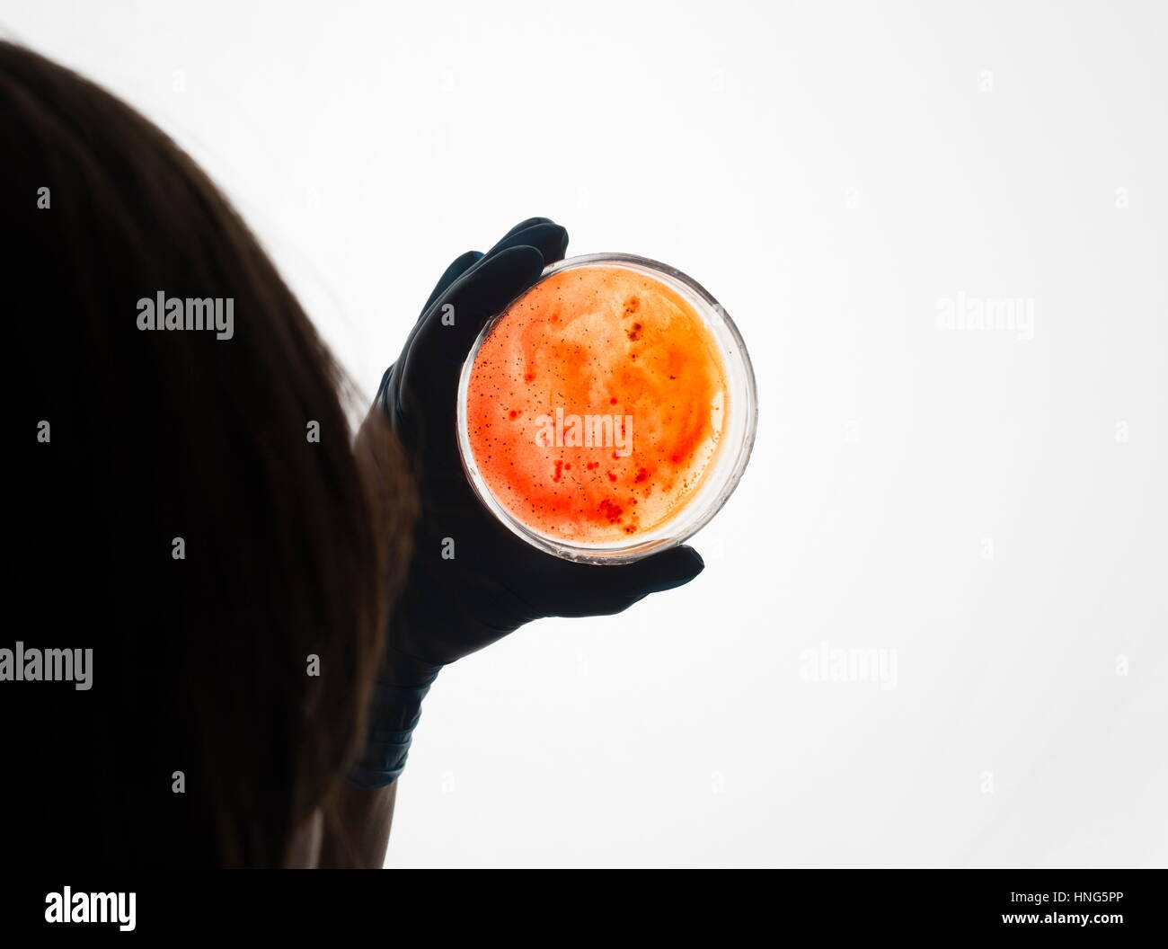 Tecnico di laboratorio prove per intestinale infezione batterica, mano trattiene il test campione nella scatola di Petri.colonie batteriche di crescita. Medical Hospital resea Foto Stock