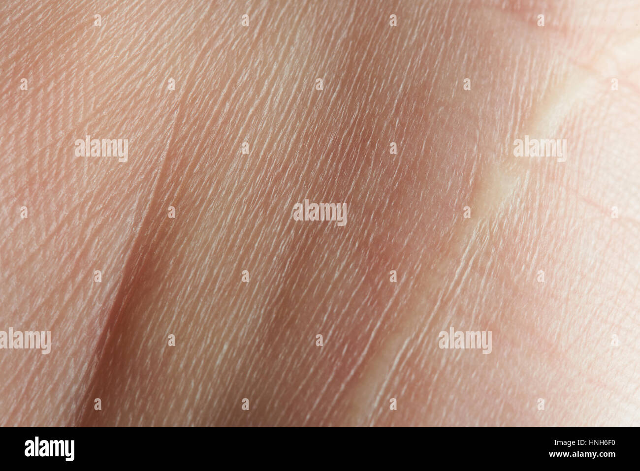Pelle sul palmo della mano closeup. Texture di giovani caucasici umano pelle Foto Stock