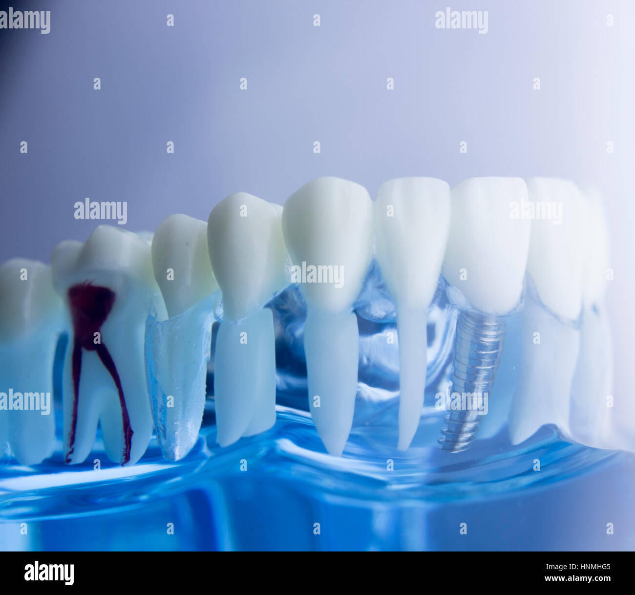 Modello Dentale Tipodont Easyinsmile Per Bambini E Studenti