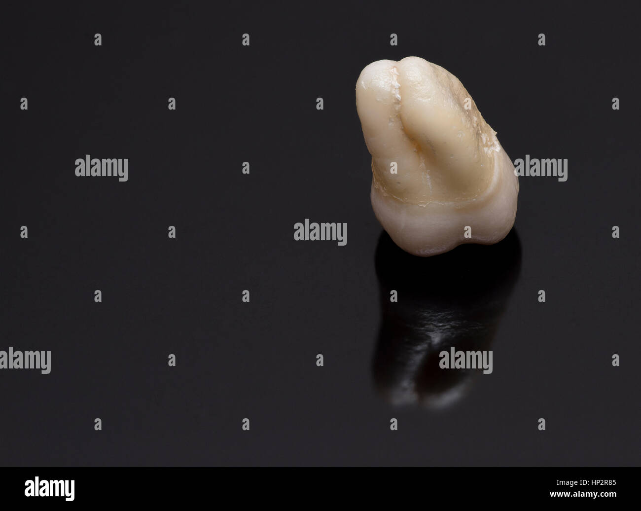 Vista dettagliata del dente umano su uno sfondo nero Foto Stock