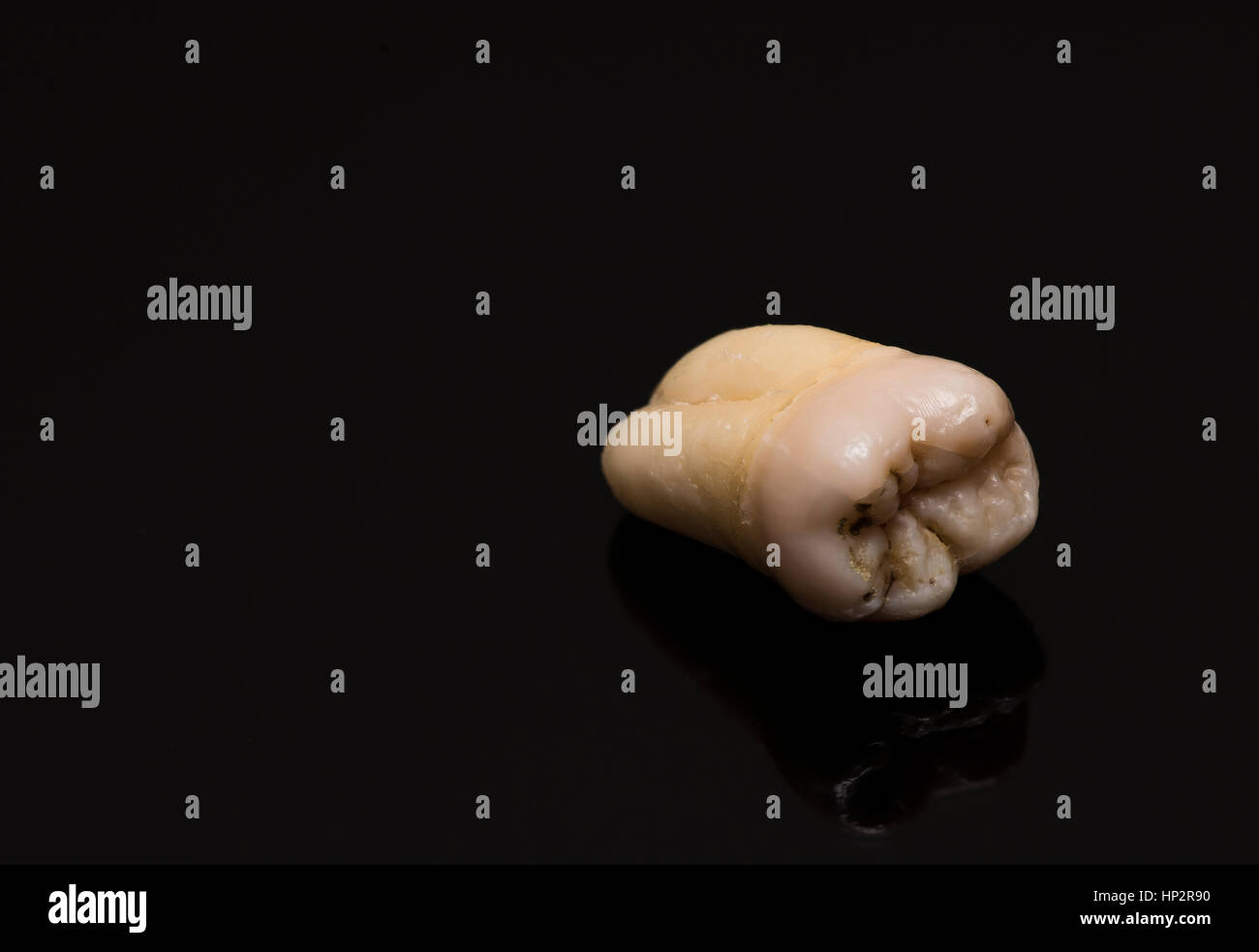 Close-up di dente umano su uno sfondo nero Foto Stock