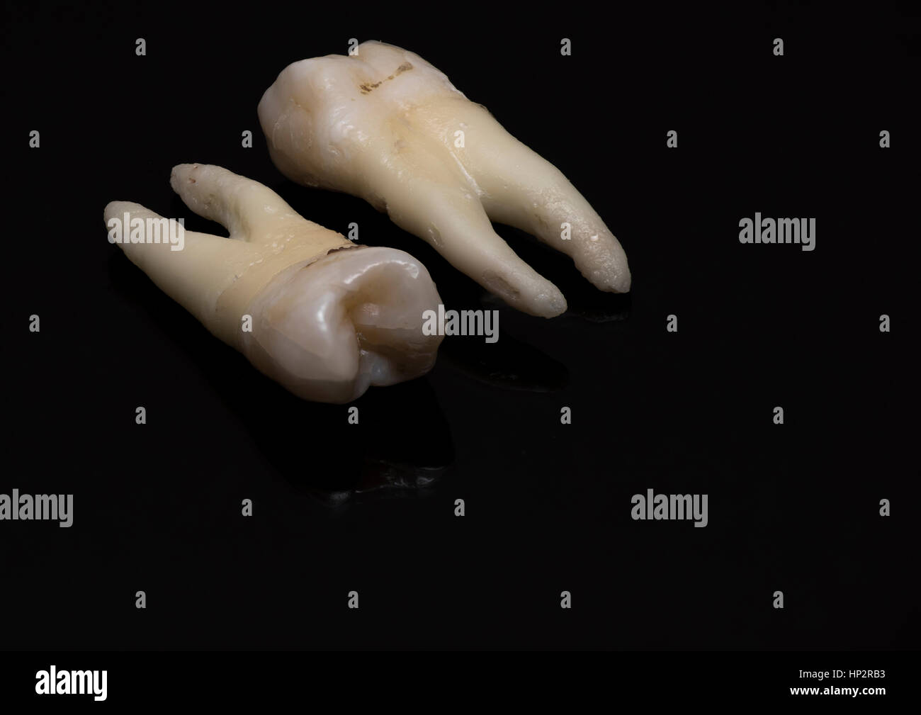 Close-up di denti umani su sfondo nero Foto Stock