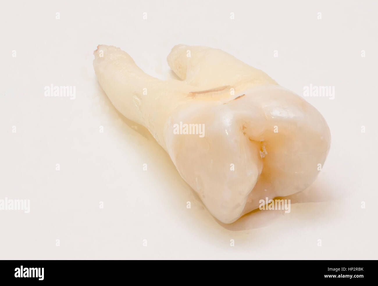 Close-up di dente umano su sfondo bianco Foto Stock