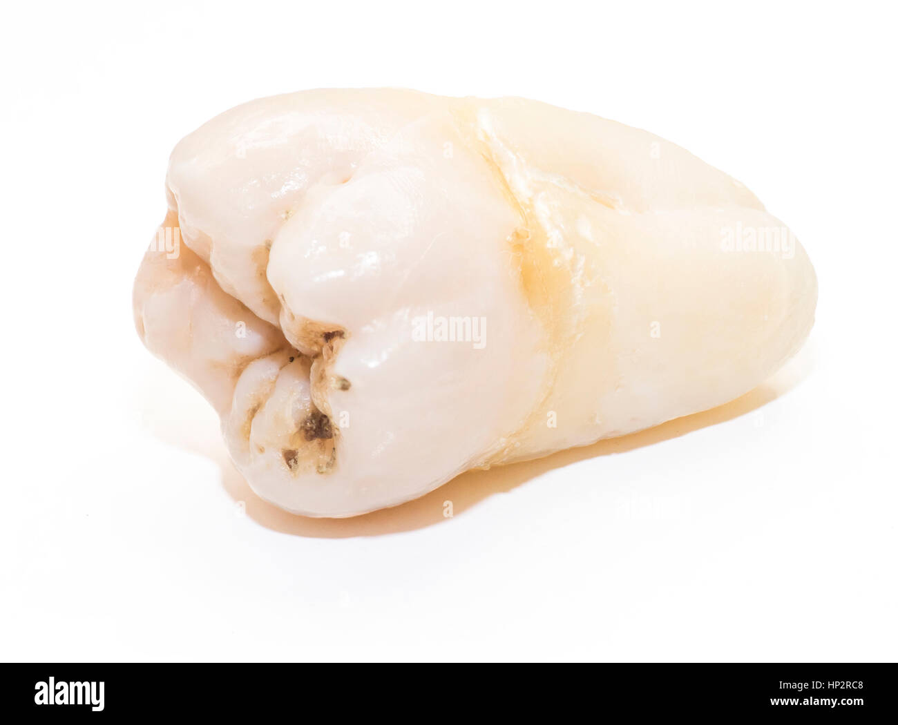 Close-up di dente umano su sfondo bianco Foto Stock